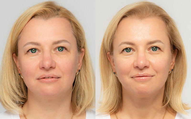 meder age-defying routine results